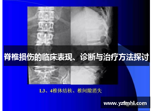 脊椎损伤的临床表现、诊断与治疗方法探讨